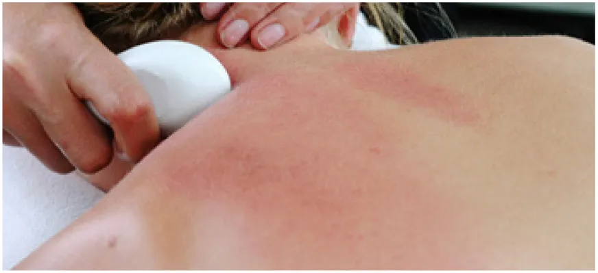 Trattamento gua sha sulla schiena con una pietra levigata